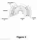 Fig. 04 - Ferrofluidic cooling and acoustical noise reduction in magnetic stimulators
