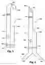 Fig. 03 - Multilumen catheter for minimizing limb ischemia