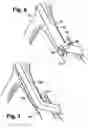 Fig. 05 - Multilumen catheter for minimizing limb ischemia