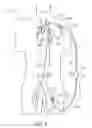 Fig. 06 - Implantable heart assist system and method of applying same