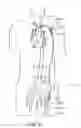 Fig. 07 - Implantable heart assist system and method of applying same