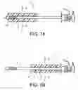 Fig. 05 - Method and system for minimizing leakage of a distending medium during endoscopic procedures