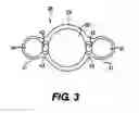 Fig. 04 - Controllable endoscopic sheath apparatus and related method of use