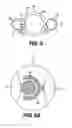 Fig. 07 - Controllable endoscopic sheath apparatus and related method of use