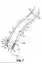 Fig. 08 - Controllable endoscopic sheath apparatus and related method of use