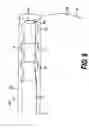 Fig. 10 - Controllable endoscopic sheath apparatus and related method of use