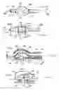 Fig. 11 - Anoscope for treating hemorrhoids without the trauma of cutting or the use of an endoscope