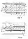 Fig. 06 - Endoscope sheath