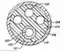 Fig. 01 - Liner for endoscope working channel