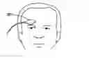 Fig. 01 - Forehead sensor placement