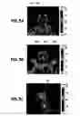Fig. 03 - Forehead sensor placement