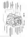 Fig. 05 - Forehead sensor placement