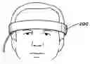 Fig. 01 - Forehead sensor placement