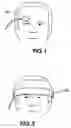 Fig. 02 - Forehead sensor placement