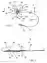 Fig. 02 - Cortical sensing device with pads