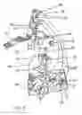 Fig. 03 - Cortical sensing device with pads
