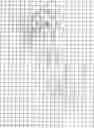 Fig. 22 - System and method for electromagnetic navigation in the vicinity of a metal object