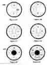 Fig. 04 - Optical biopsy system with single use needle probe