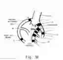 Fig. 04 - Method and device for determining the presence of an ischemic area in the heart of a human being or an animal