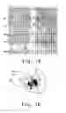 Fig. 09 - Method and device for determining the presence of an ischemic area in the heart of a human being or an animal