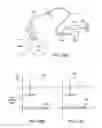 Fig. 27 - Minimally invasive determination of collateral ventilation in lungs