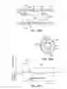 Fig. 28 - Minimally invasive determination of collateral ventilation in lungs