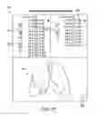 Fig. 30 - Minimally invasive determination of collateral ventilation in lungs