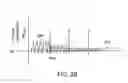 Fig. 32 - Minimally invasive determination of collateral ventilation in lungs