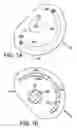 Fig. 02 - Methods of and apparatus for determining fluid volume presence in mammalian tissue