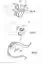 Fig. 20 - Verification method and system for medical treatment