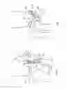 Fig. 02 - Hip orthosis, method for preventing the dislocation of a hip and use of a hip orthosis