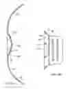 Fig. 05 - Dome-shaped back brace