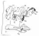 Fig. 01 - Hand orthosis