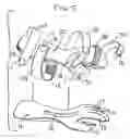 Fig. 03 - Hand orthosis