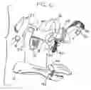 Fig. 04 - Hand orthosis