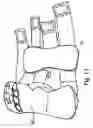 Fig. 10 - Hand orthosis