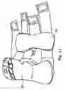 Fig. 11 - Hand orthosis
