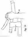 Fig. 14 - Hand orthosis