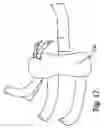 Fig. 17 - Hand orthosis