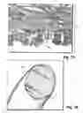 Fig. 06 - Medical device