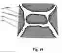 Fig. 15 - Medical device