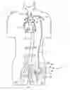 Fig. 01 - Cannulae having a redirecting tip