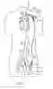 Fig. 04 - Cannulae having a redirecting tip