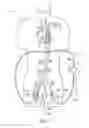 Fig. 08 - Cannulae having a redirecting tip