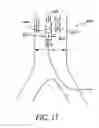 Fig. 16 - Cannulae having a redirecting tip