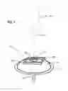 Fig. 02 - Infusion device