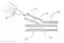 Fig. 01 - Controlled failure balloon catheter assemblies