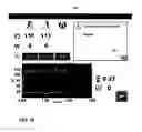 Fig. 16 - User interface for a portable therapy delivery device