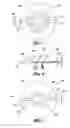 Fig. 03 - Syringe