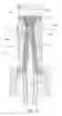 Fig. 14 - Medical valve and method of use